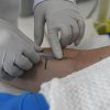 SES divulga nota reforçando vigilância e MS segue sem casos confirmados de hantavirose há 7 anos