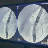Exame inédito marca avanço da alta complexidade no Hospital Regional de Dourados